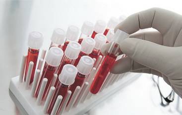 Анализы, УЗИ, консультация